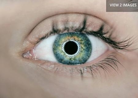 Как 3D-печать роговицы вернула зрение слепому пациенту в Израиле?
