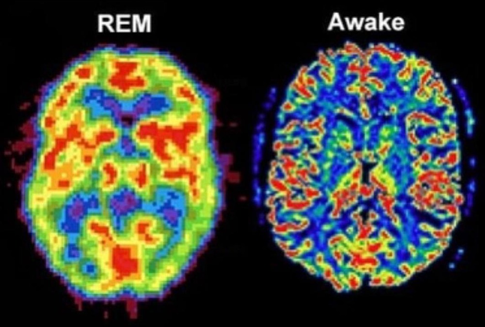 Почему сон под сериалы опасен?
