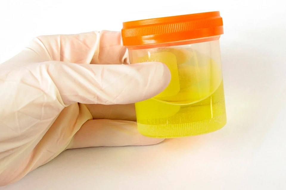 В Санкт-Петербурге были пойманы двое мужчин, которые, по данным следствия, украли контейнеры для анализов из машины скорой помощи