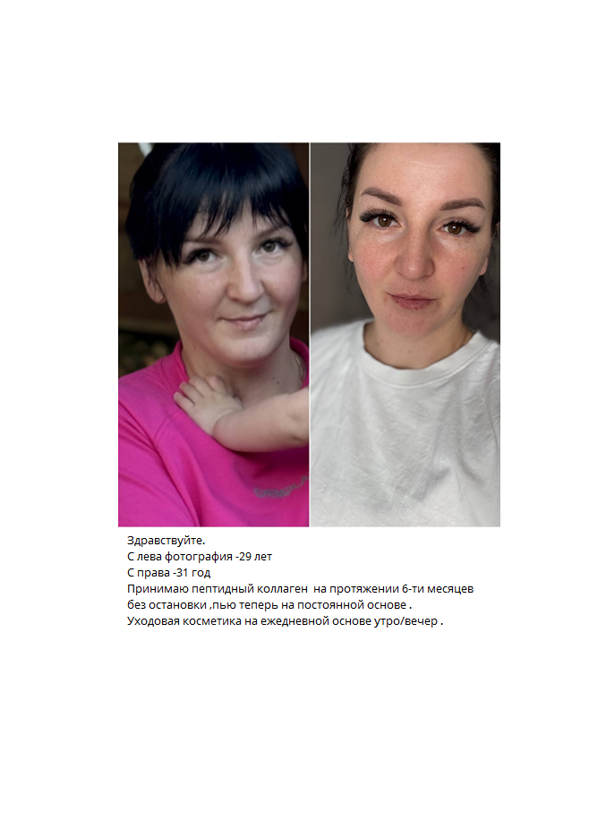 Как вернуть коже молодость: история преображения с тройным коллагеном