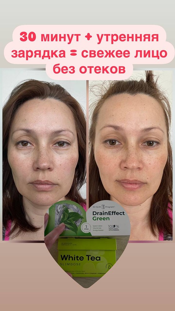 Как убрать отеки и уменьшить талию: работает ли лимфодренаж?