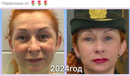 Как избавиться от отеков за 30 минут: натуральный дренажный эффект