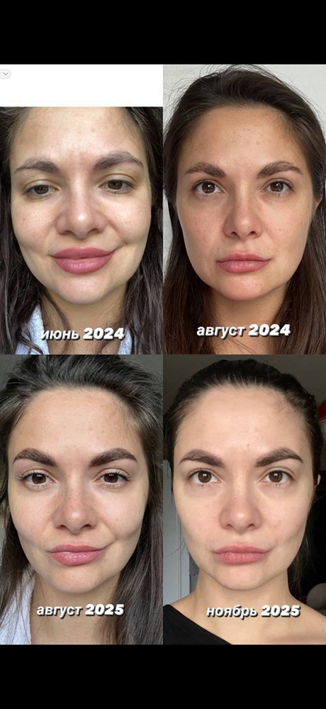 Как я победила отёки: идеальное комбо LYMPH GYAN + DrainEffect