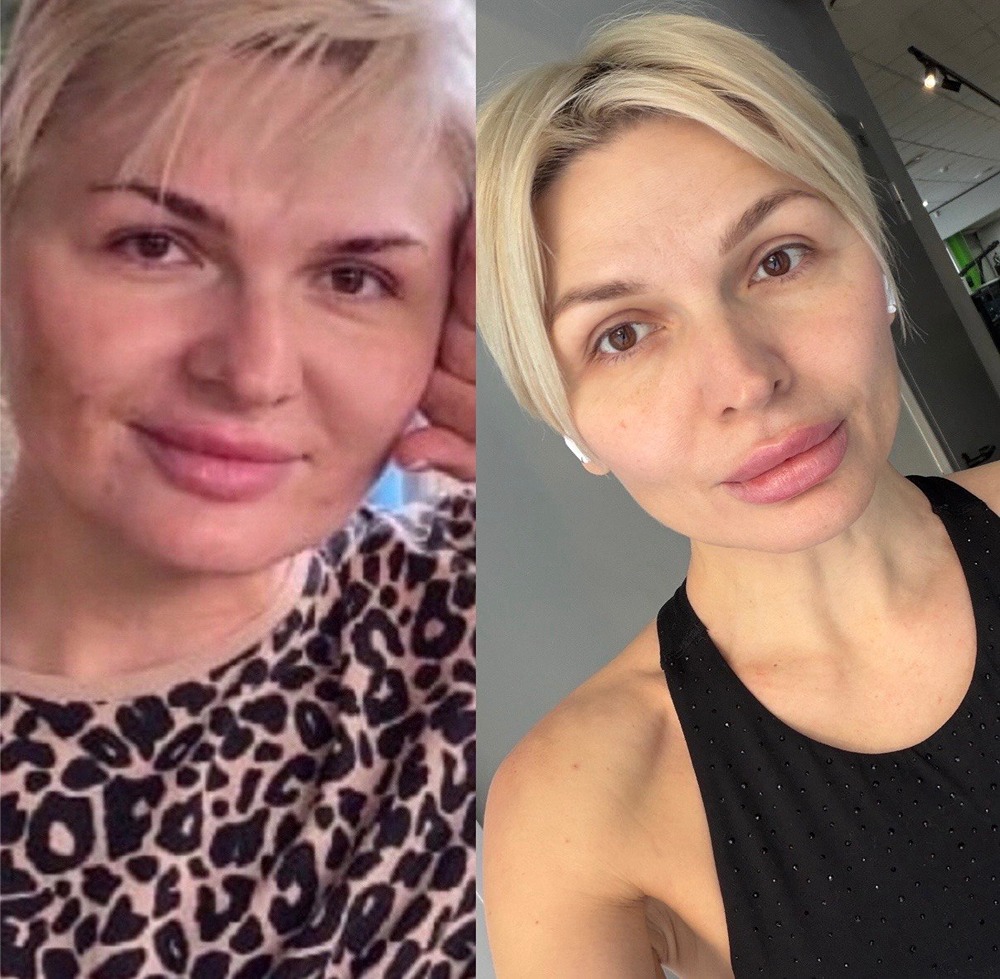 Collagen Trinity: почему этот коллаген стал фаворитом 2026 года?