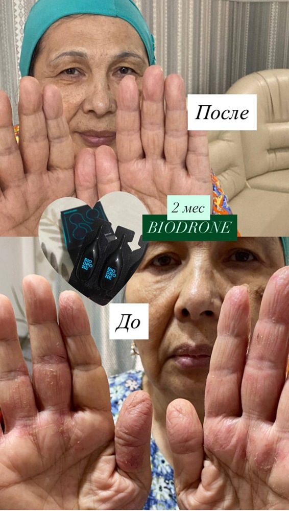 Как я победила глубокие трещины на руках: история восстановления кожи изнутри