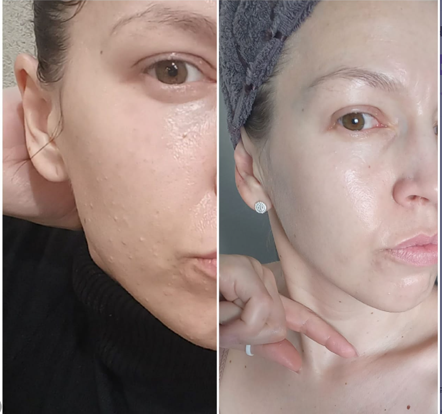 Как адаптировать уход за лицом под свой график: секреты двухфазного крема Biome