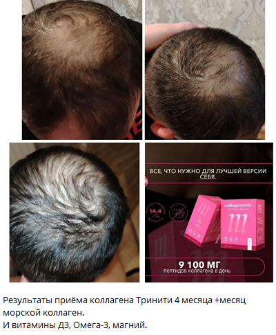 Как остановить старение организма после 30: роль коллагена в здоровье суставов?