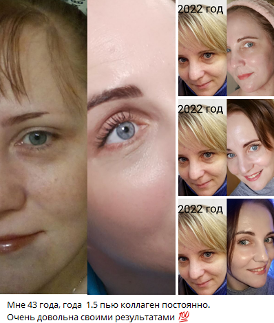 Правда о коллагене: почему дорогие кремы не работают после 35