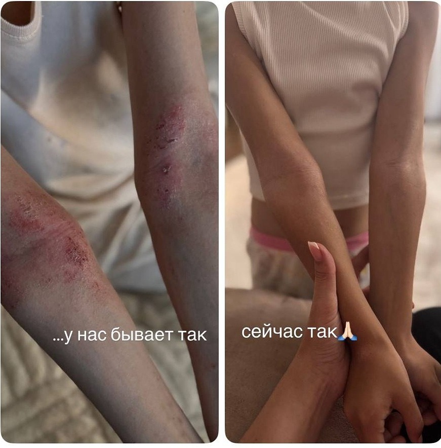 Как усилить иммунитет природными адаптогенами