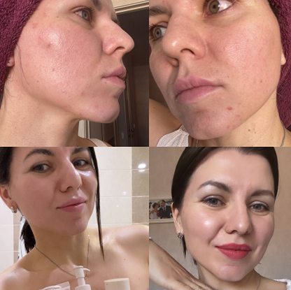 Как добиться идеального тона лица без фильтров: топ-3 средства для сияющей кожи