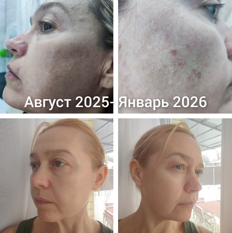 Как начать любить себя: утренний ритуал красоты для внутреннего сияния