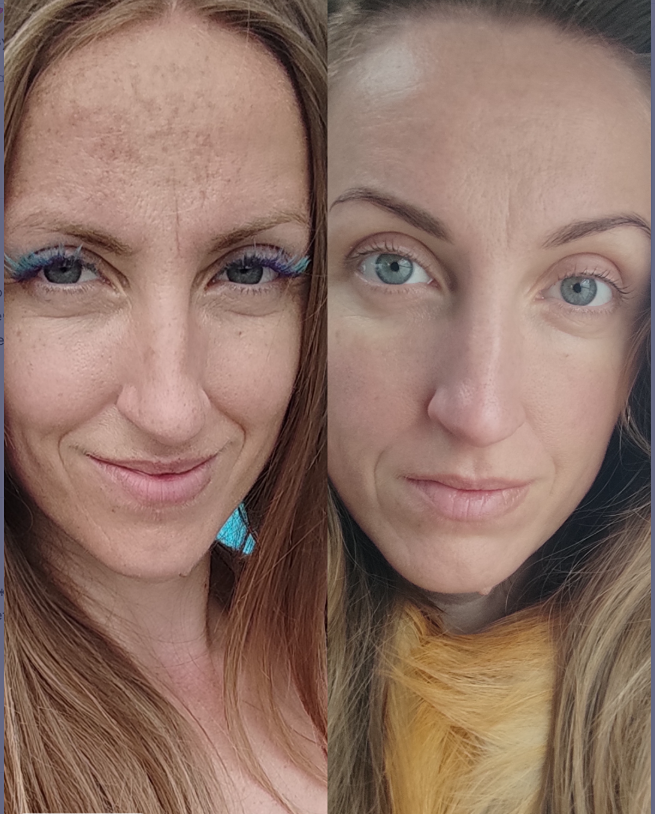 Как вернуть коже сияние без кремов: революционный anti-age напиток