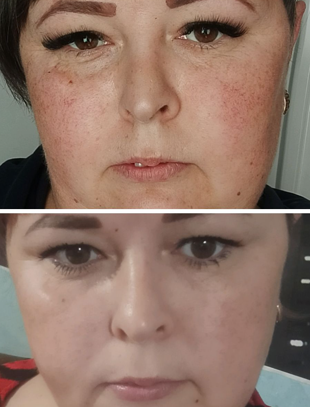 Корейская магия очищения: как бабл-пудра с углем преображает кожу