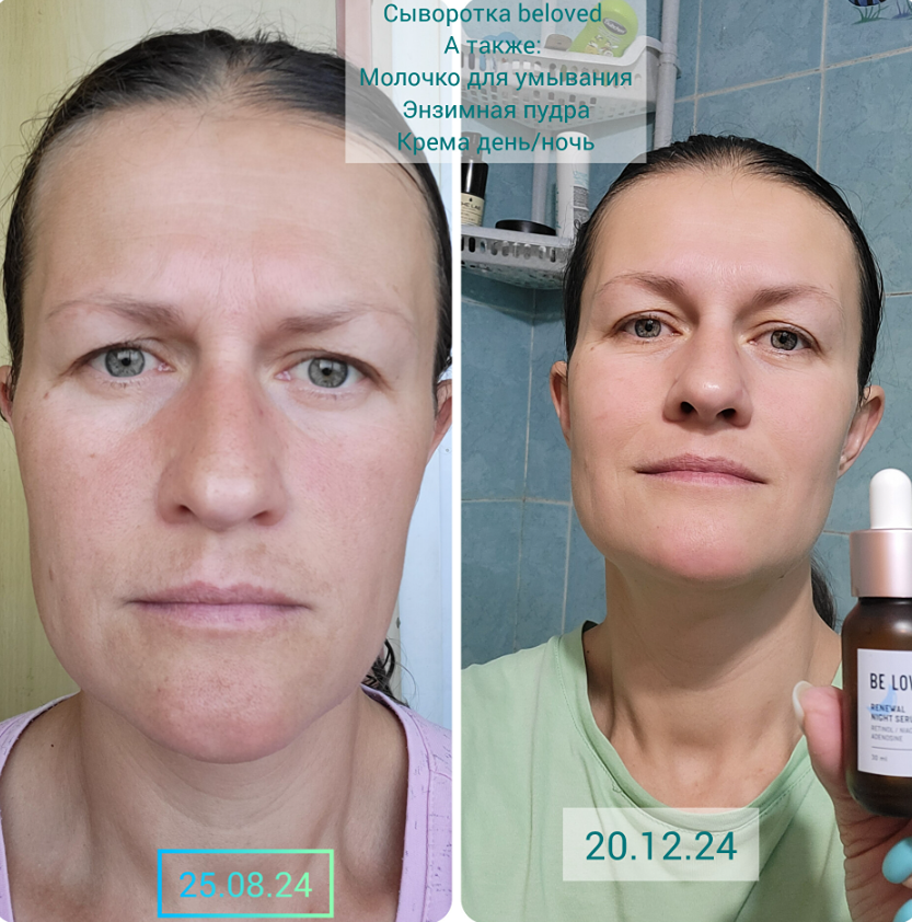 Как проснуться с лицом после отпуска: ночная сыворотка с ретинолом творит чудеса