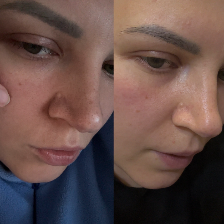 Ночная сыворотка с ретинолом: как проснуться с идеальной кожей