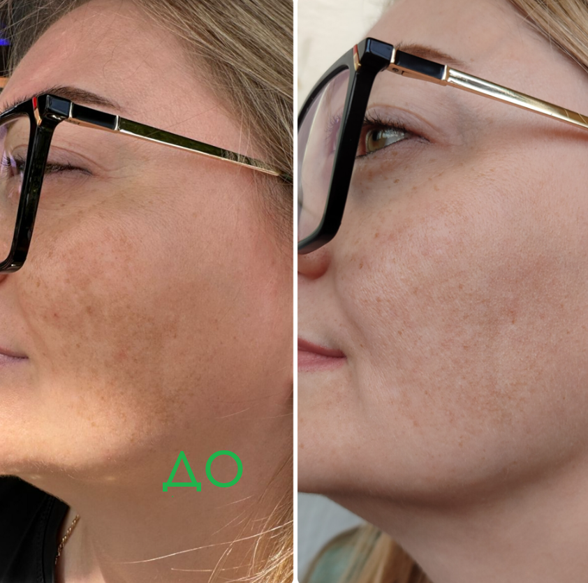 Как регенерирующая сыворотка с пептидами помогает уставшей коже: твой секрет сияния