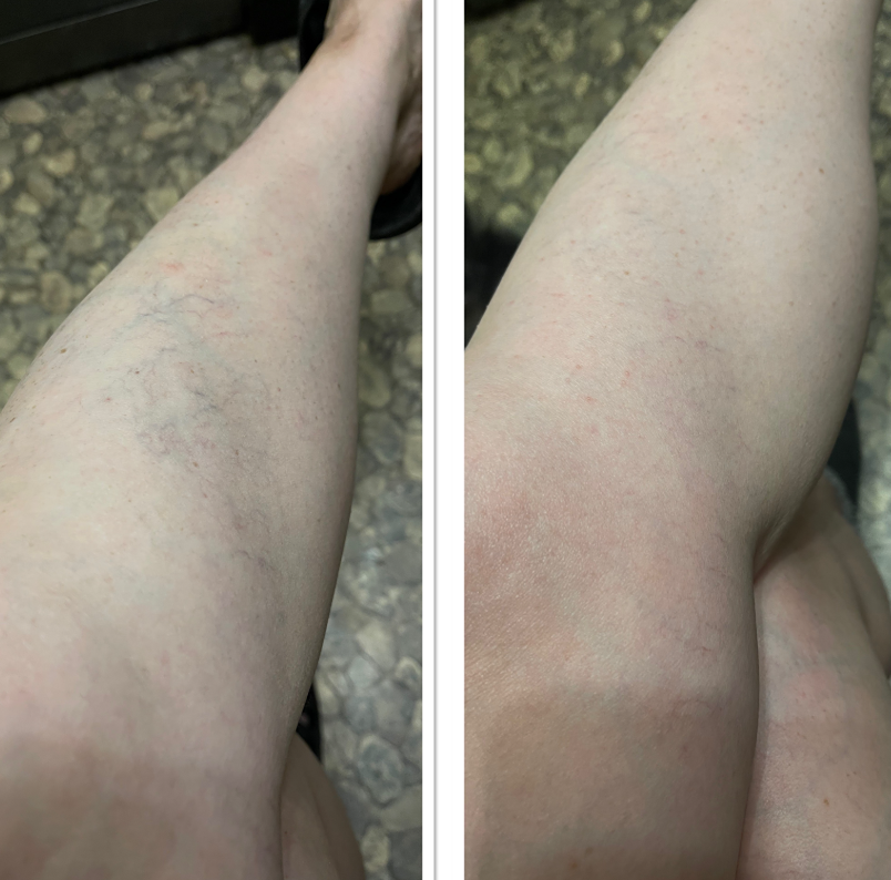 Как сила сибирской пихты помогает восстановить здоровье на клеточном уровне?