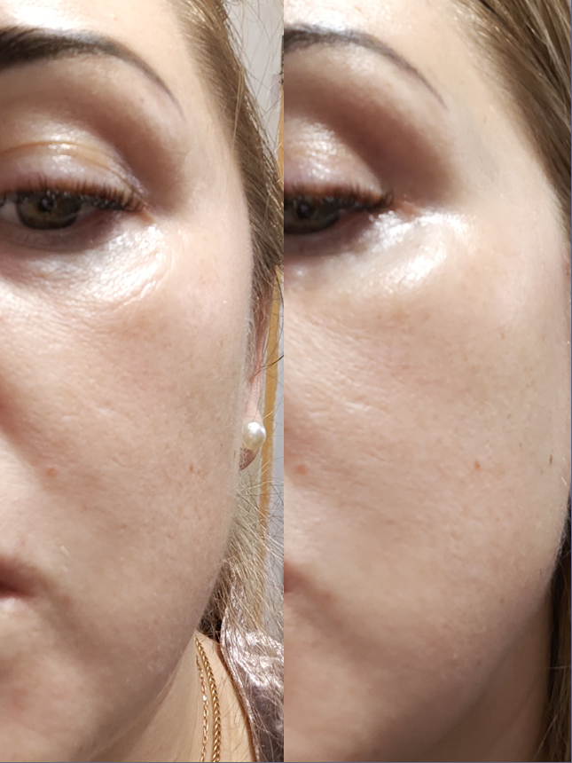 Патчи с драгоценными камнями: как элитная косметика преображает кожу за 20 минут