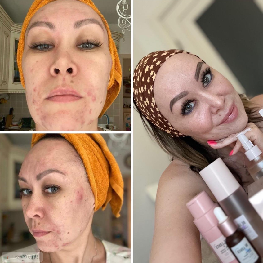 Очищение кишечника и печени: мой проверенный путь к здоровью