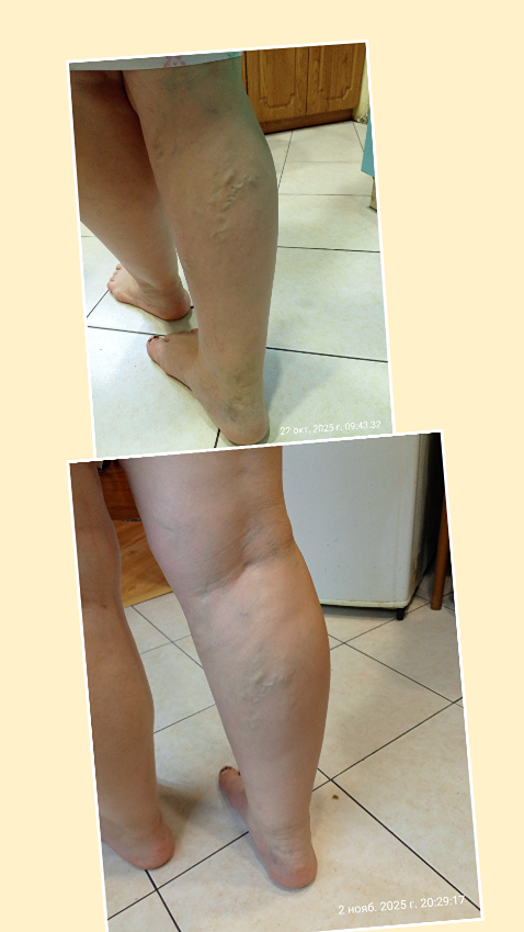 Как укрепить сосуды и защитить сердце: ваш персональный план здоровья