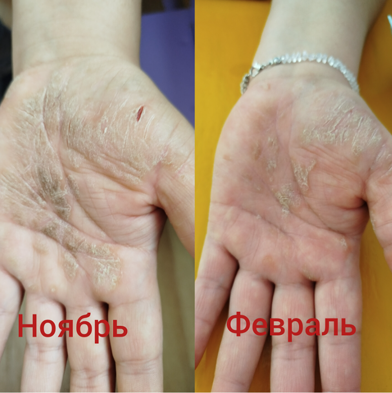 Как очистить организм и укрепить иммунитет: природный метод защиты