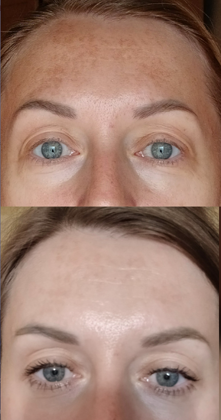 Эликсир молодости: как напиток красоты преображает кожу изнутри