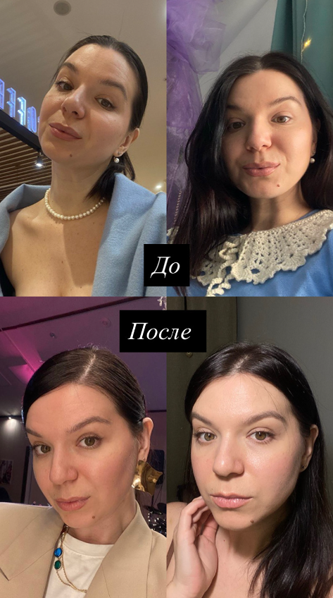 Как избавиться от отеков и тяжести к вечеру: работа с лимфой изнутри