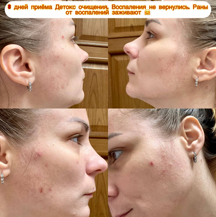 Три шага к обновлению: программа естественного очищения организма