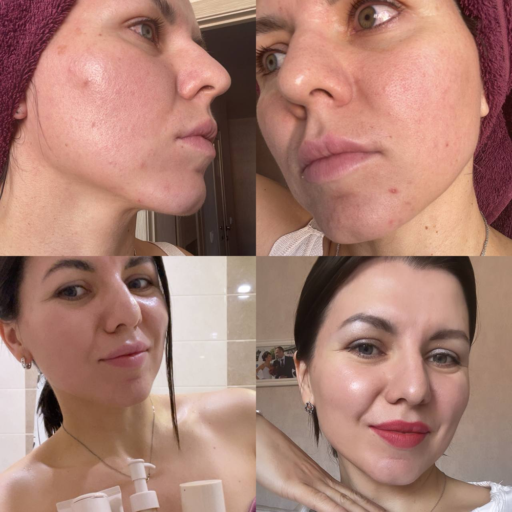 Детокс для тела: как вернуть легкость и сияние изнутри