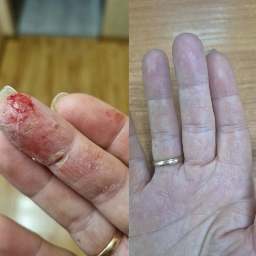 Сияющая кожа без аптечки: секрет внутреннего преображения раскрыт