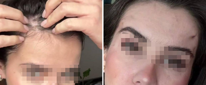 Скандал в элитной клинике: как неудачная операция привела к обвинениям в домогательствах