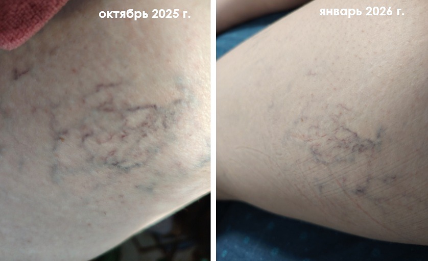 Секрет сияющей кожи в здоровье сосудов: разбираем действие Beauty blend