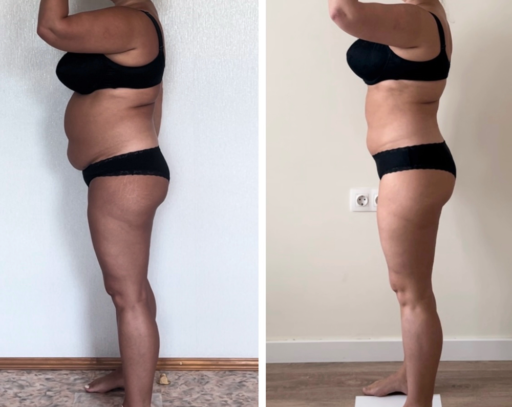 От отёков к лёгкости: комбо‑эффект White Tea и DrainEffect