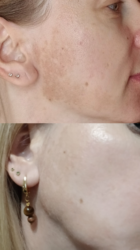 Как «напоить» клетки? Секрет сияющей кожи без кремов