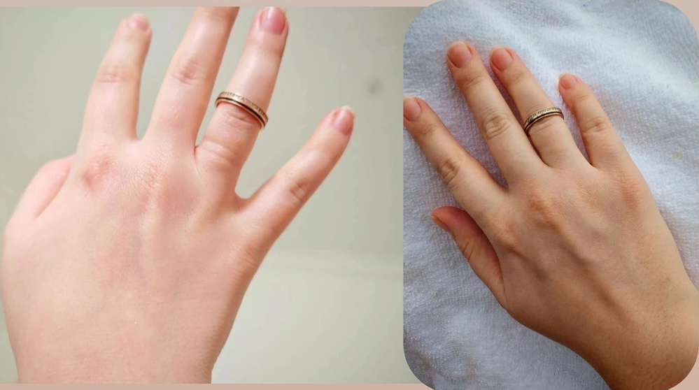 Минус 2–3 см в талии: DrainEffect запускает лимфоток