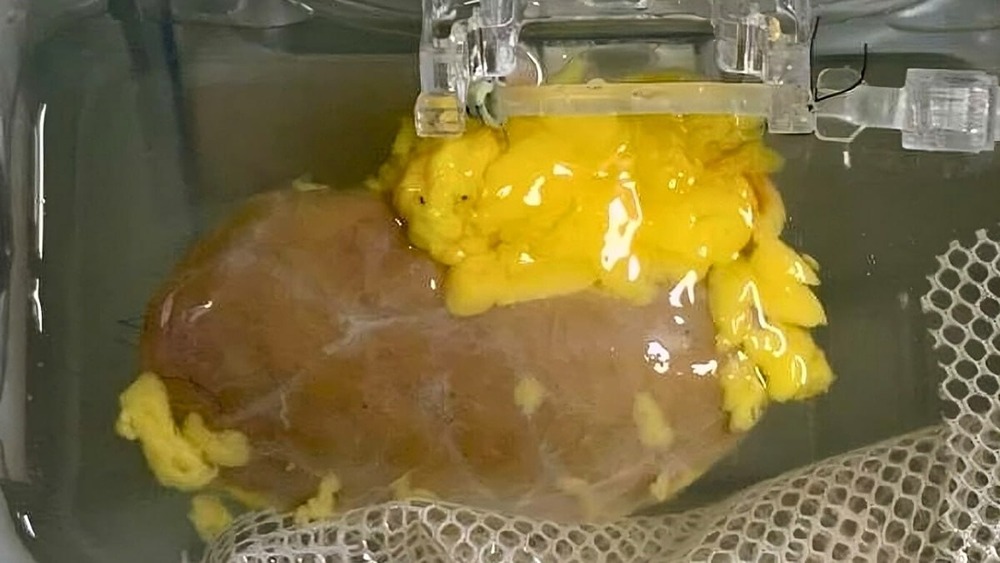 Прорыв в медицине: создана почка, подходящая всем группам крови