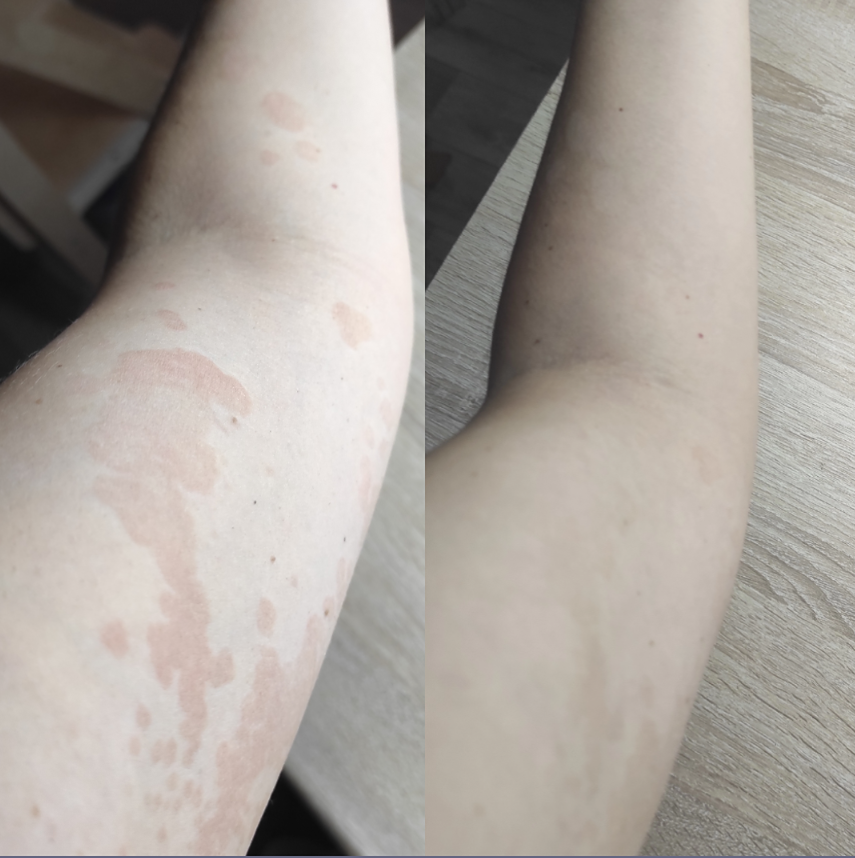 Печень устала от стресса и кофе? Как ей помочь без жёстких диет?