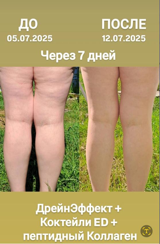 Как вернуть коже тонус и лоск: эффект фотофильтра для тела?