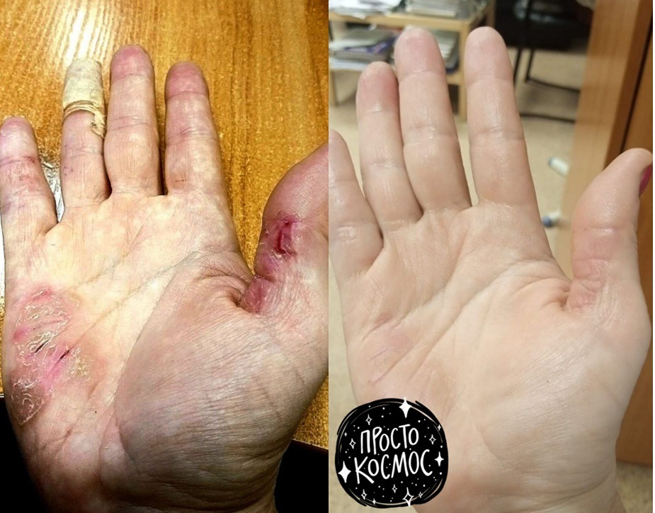 Детокс от NL: реально ли очистить организм без стресса?