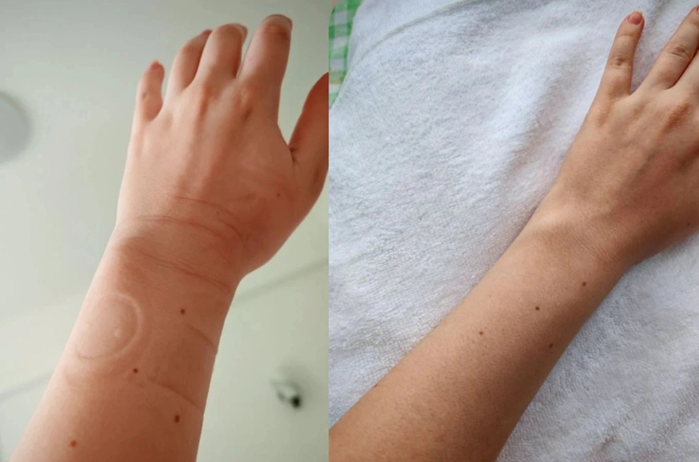 Скрытый ресурс здоровья: аюрведический комплекс, который «разгоняет» лимфу