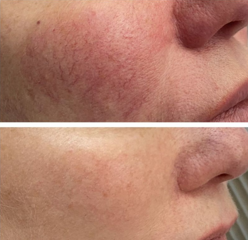 Тайный эликсир красоты: что в составе Beauty blend, что даёт сияние кожи