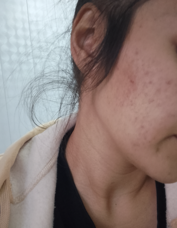 Почему кожа тускнеет, даже если ухаживать за ней? Ответ — в очищении