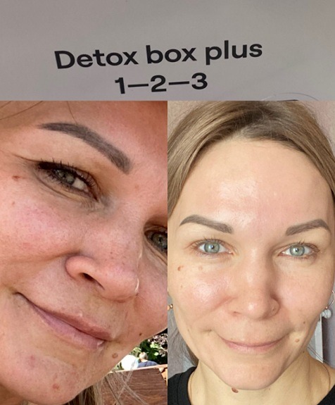 Детокс помогает коже: минус отёки, плюс энергия — мой опыт с NL
