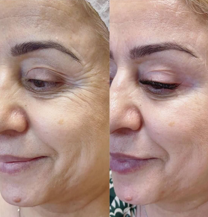 Секрет молодости в одном стике: что скрывает формула коллагена 3‑в‑1