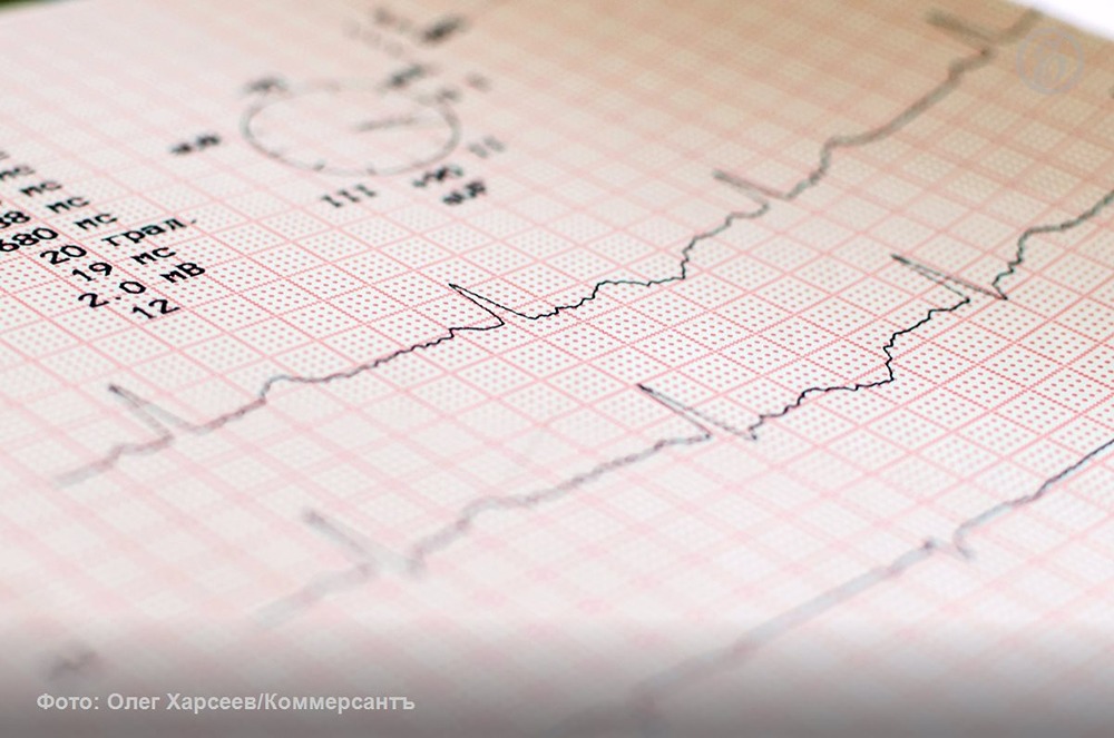 ИИ помог выявить 11 тыс. москвичей с ишемической болезнью сердца