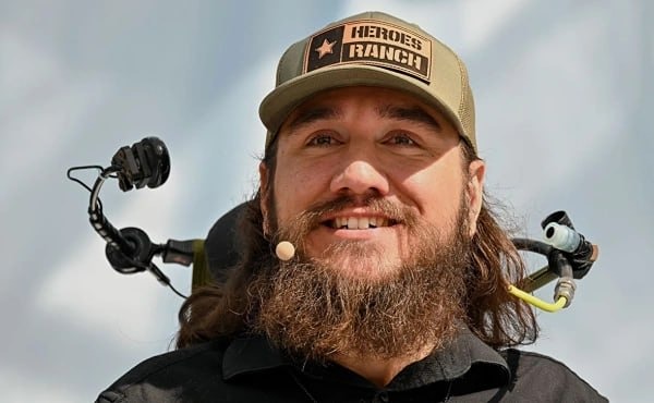 Как живёт первый пациент Neuralink с чипом спустя 2 года?