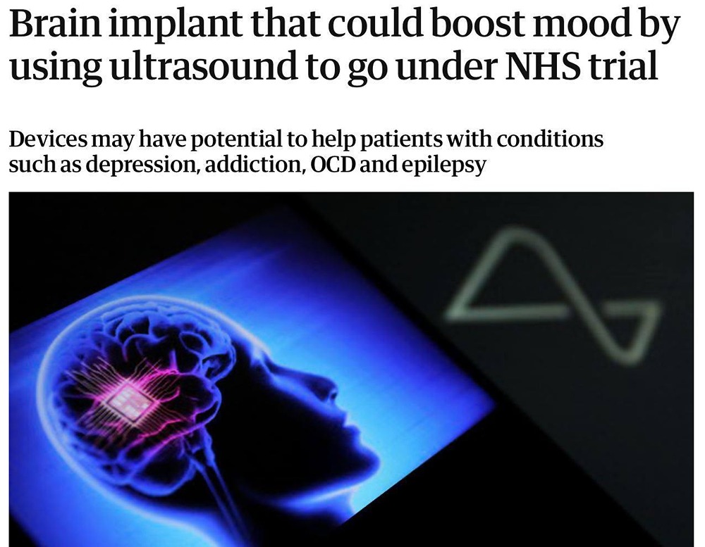 В Великобритании разработан нейрочип, который, как ожидается, поможет в лечении депрессии
