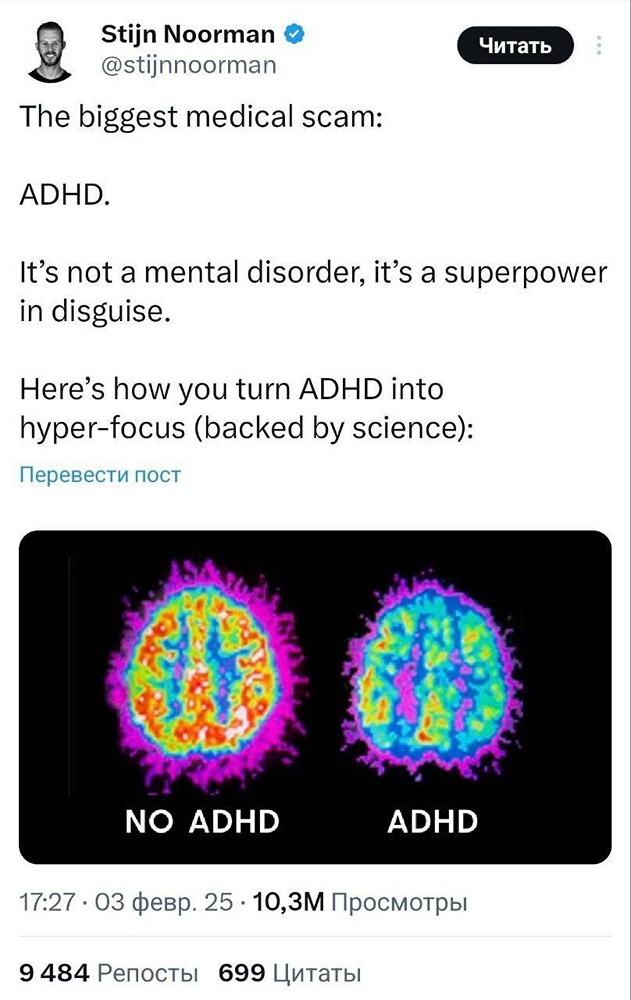 Синдром дефицита внимания и гиперактивности (СДВГ) — это не заболевание, а скорее скрытый потенциал, который можно раскрыть и направить на достижение своих целей, считает специалист