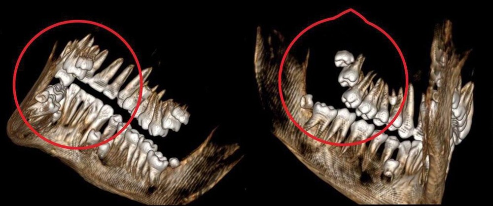 Как решить проблему с прикусом?