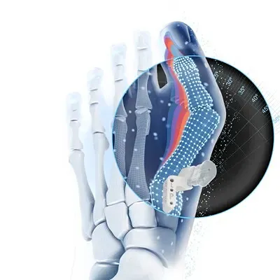 Johnson & Johnson MedTech запустила VIRTUGUIDE™ — ИИ-решение для операций при вальгусной деформации стопы